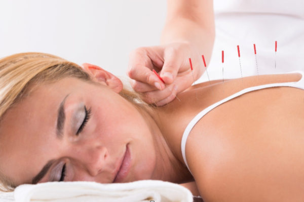 Acupuncture for Chronic Pain